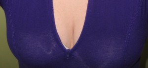 small Breast